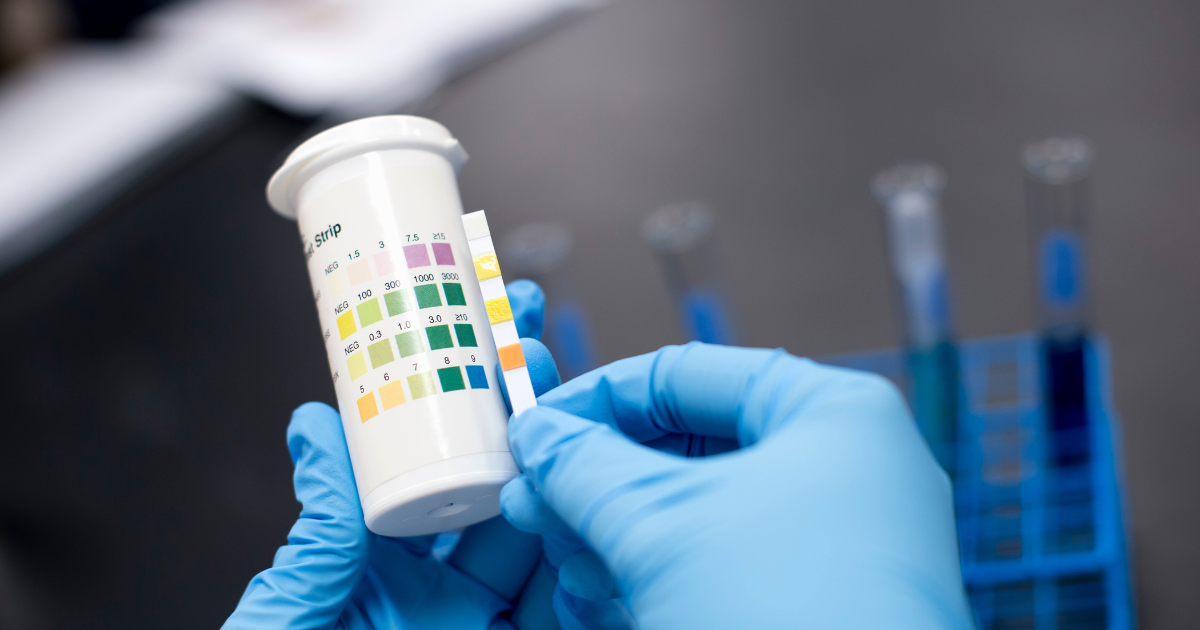 Can 7‑OH Show Up on a Drug Test? A Clear, No‑Nonsense Guide