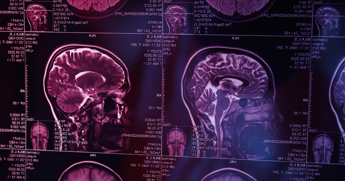 How 7-OH Works in the Brain and Body